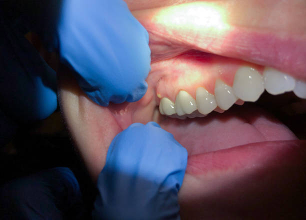 Best Cracked Tooth Emergency Dentist  in Corona De Tucson, AZ